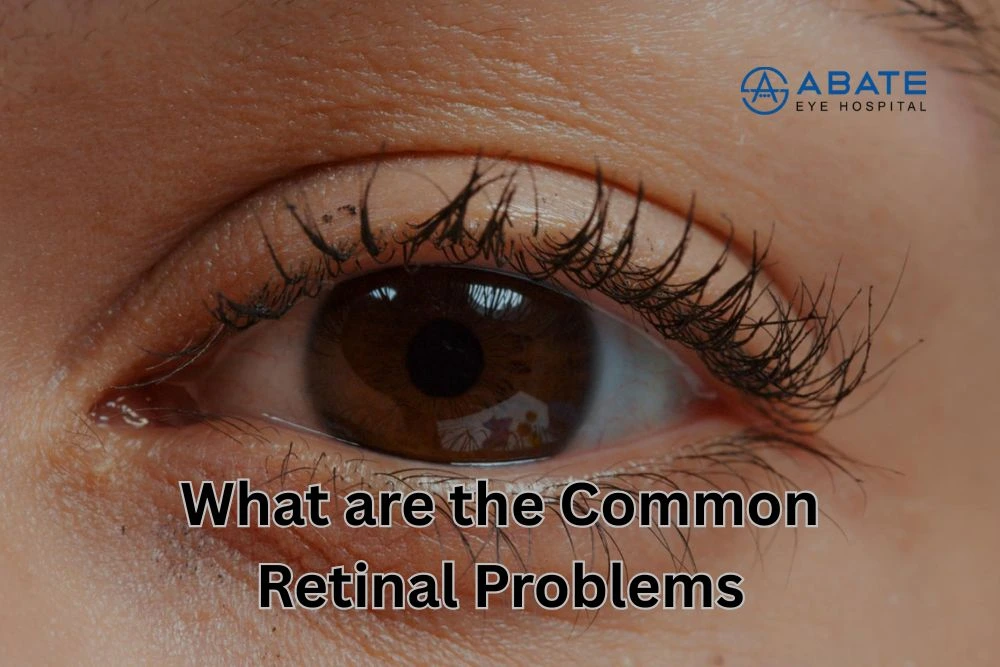 Common Retinal Problems: Causes, Symptoms, and Treatments
