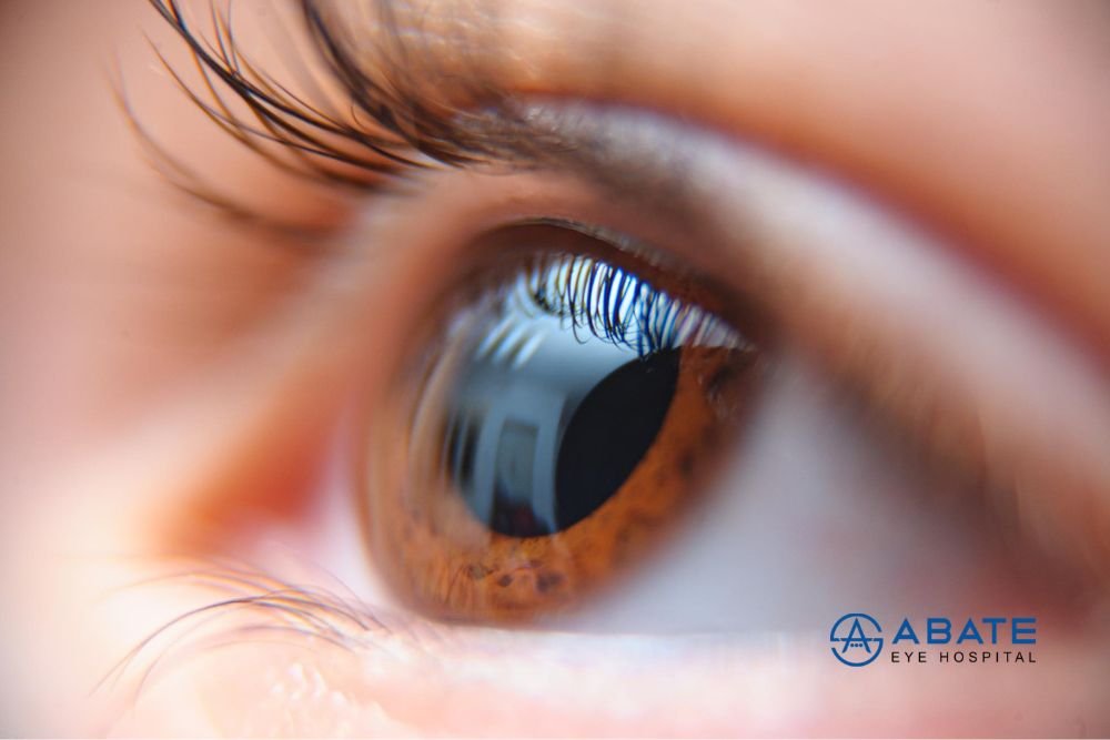 Cornea Care: The Complete Expert Guide to Maintaining Clear Vision and Long-Term Eye Health