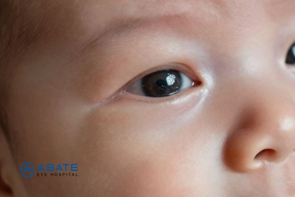 Newborn Eye Watering: Causes, Symptoms, Treatment, and When Parents Should Worry